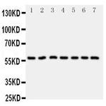 CYP11B1 Polyclonal Antibody