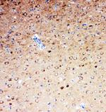 SLC6A4 Polyclonal Antibody