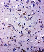 TRPC6 Antibody in Immunohistochemistry (Paraffin) (IHC (P))