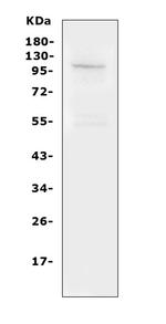 TRPC6 Antibody in Western Blot (WB)
