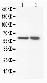 FMO3 Polyclonal Antibody