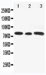 GLI3 Polyclonal Antibody