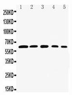 RelB Polyclonal Antibody