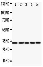 E2F6 Polyclonal Antibody