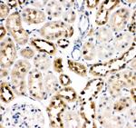 HSC70 Antibody in Immunohistochemistry (Paraffin) (IHC (P))