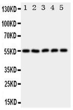 HYAL2 Polyclonal Antibody
