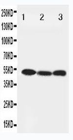 Beclin 1 Polyclonal Antibody