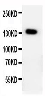 PTCH2 Polyclonal Antibody