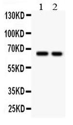 TGFBR2 Polyclonal Antibody