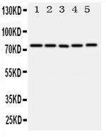 ABCG1 Polyclonal Antibody