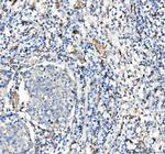 CD163 Antibody in Immunohistochemistry (Paraffin) (IHC (P))
