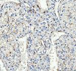 CD163 Polyclonal Antibody