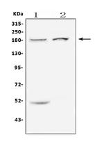 ErbB3 Antibody in Western Blot (WB)