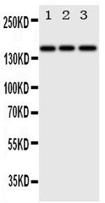 ErbB4 Polyclonal Antibody