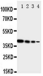 ErbB4 Antibody in Western Blot (WB)