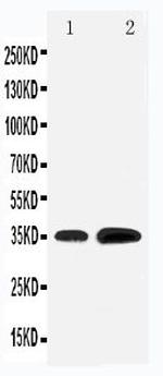KLF3 Polyclonal Antibody