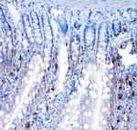 TrxR2 Polyclonal Antibody