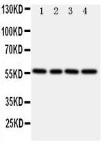 TrxR2 Antibody in Western Blot (WB)