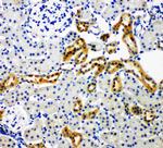 NOX4 Polyclonal Antibody
