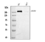 ZEB2 Antibody in Western Blot (WB)