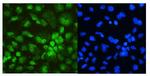 DDX5 Polyclonal Antibody