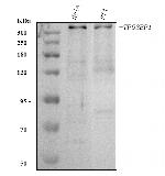 53BP1 Antibody in Western Blot (WB)