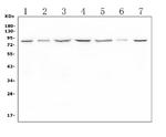 LTK Polyclonal Antibody