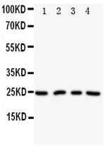 NPM2 Polyclonal Antibody