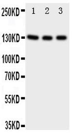TrkC Polyclonal Antibody