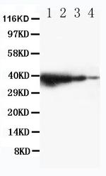 TRIF Polyclonal Antibody