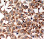 TRAF2 Polyclonal Antibody