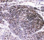 TRAF4 Polyclonal Antibody