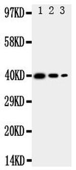 TRAM2 Polyclonal Antibody