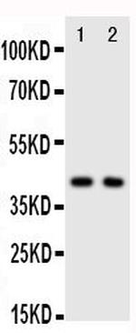 CXCR5 Polyclonal Antibody
