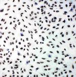 PERK Antibody in Immunocytochemistry (ICC/IF)