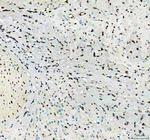 Flotillin 1 Antibody in Immunohistochemistry (Paraffin) (IHC (P))