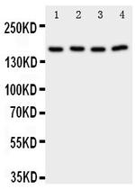 PLA2G4A Polyclonal Antibody