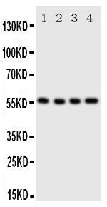 SLC2A5 Polyclonal Antibody