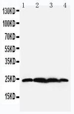 BAG2 Polyclonal Antibody