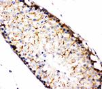 TBK1 Antibody in Immunohistochemistry (Paraffin) (IHC (P))