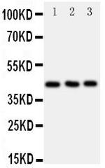 CCR9 Polyclonal Antibody