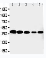 CDK7 Polyclonal Antibody