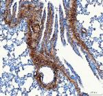 COL1A1 Antibody in Immunohistochemistry (Paraffin) (IHC (P))