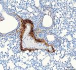 COL1A1 Antibody in Immunohistochemistry (Paraffin) (IHC (P))