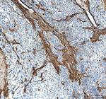 COL1A1 Antibody in Immunohistochemistry (Paraffin) (IHC (P))