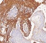 COL1A1 Antibody in Immunohistochemistry (Paraffin) (IHC (P))