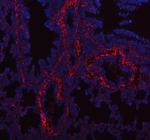 COL1A1 Antibody in Immunohistochemistry (Paraffin) (IHC (P))