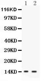 FABP6 Antibody in Western Blot (WB)