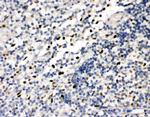FLI1 Polyclonal Antibody