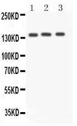 ACE Polyclonal Antibody